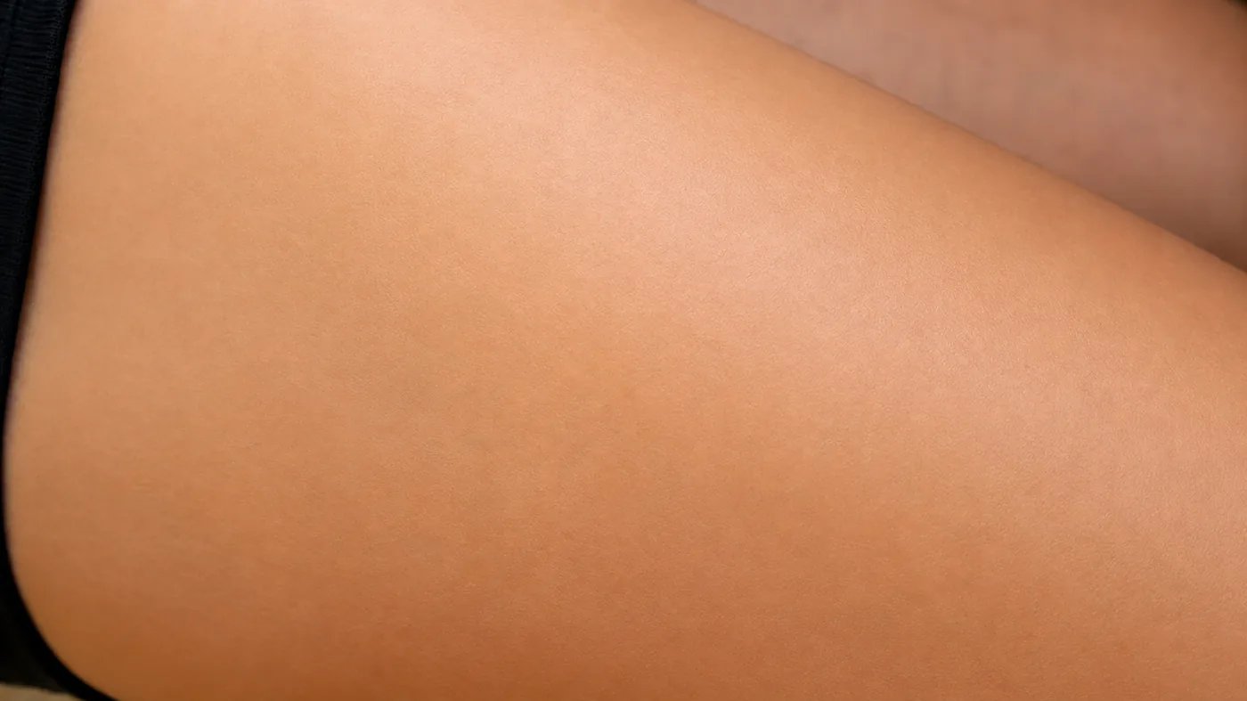 Depois: perna com pele lisa, sem pelos, após tratamento na Fitlaser